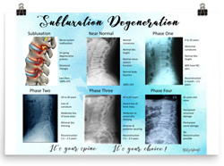 Lumbar Subluxation Degeneration Poster